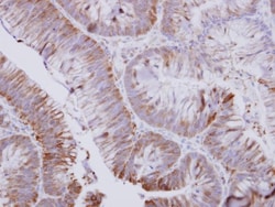 UMPS Antibody, Novus Biologicals 0.1mL; Unlabeled:Antibodies, Polyclonal