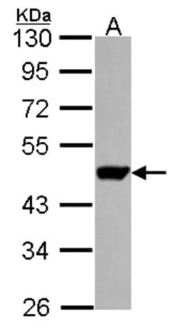 UMPS Antibody, Novus Biologicals 0.1mL; Unlabeled:Antibodies, Polyclonal