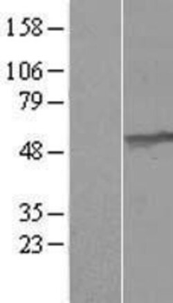 Novus Biologicals&trade;&nbsp;UMPS Overexpression Lysate