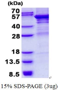 Novus Biologicals&trade;&nbsp;Recombinant Human UMPS His Protein