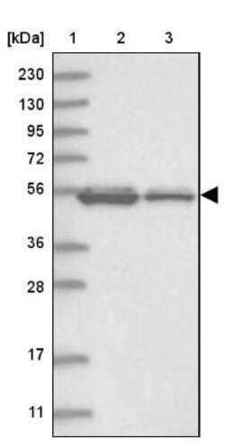 UMPS Antibody, Novus Biologicals 25 &mu;L | Buy Online | Novus Biologicals | Fisher Scientific