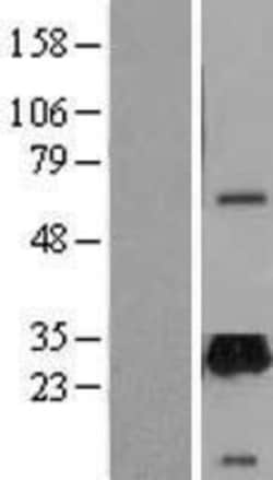 Novus Biologicals™ UNC119 Overexpression Lysate