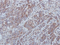 UNC13B Antibody, Novus Biologicals 100 ul; Unconjugated:Antibodies, Polyclonal