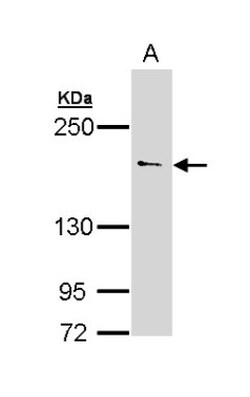 UNC13B Antibody, Novus Biologicals 100 ul; Unconjugated:Antibodies, Polyclonal