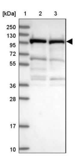 UNC45A Antibody, Novus Biologicals 25 &mu;L, Unlabeled:Antibodies, Polyclonal