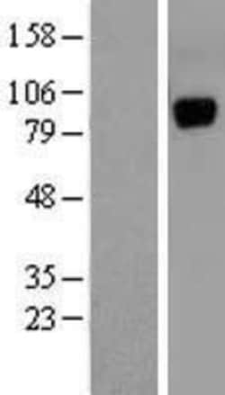 Novus Biologicals&trade;&nbsp;UNC5H1/Unc5a Overexpression Lysate