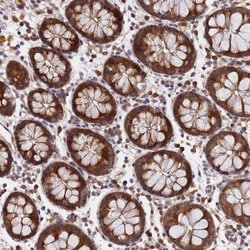 UNC93B Antibody, Novus Biologicals:Antibodies:Primary Antibodies