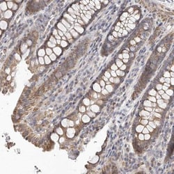 UNK Antibody, Novus Biologicals 25 μL; Unlabeled:Antibodies, Polyclonal