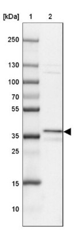 UNKL Antibody, Novus Biologicals 0.1mL; Unlabeled:Antibodies, Polyclonal