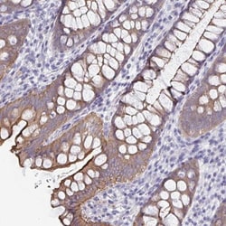 UNKL Antibody, Novus Biologicals 0.1mL; Unlabeled:Antibodies, Polyclonal