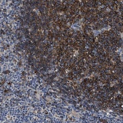 UNQ6411 Antibody, Novus Biologicals:Antibodies:Primary Antibodies
