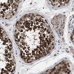 UPF3A Antibody, Novus Biologicals 0.1mL; Unlabeled:Antibodies, Polyclonal