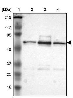 UPF3B Antibody, Novus Biologicals:Antibodies:Primary Antibodies