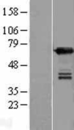 Novus Biologicals&trade;&nbsp;UPF3B Overexpression Lysate