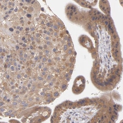 UPF3B Antibody, Novus Biologicals 0.1mL; Unlabeled:Antibodies, Polyclonal
