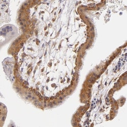 UPF3B Antibody, Novus Biologicals:Antibodies:Primary Antibodies