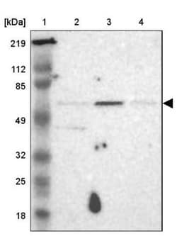 UPF3B Antibody, Novus Biologicals 0.1mL; Unlabeled:Antibodies, Polyclonal