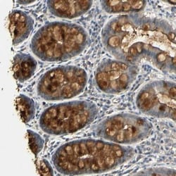 u-Plasminogen Activator/Urokinase Antibody, Novus Biologicals:Antibodies:Primary