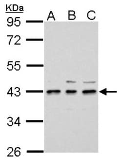 UPP2 Antibody, Novus Biologicals 0.1mL; Unlabeled:Antibodies, Polyclonal
