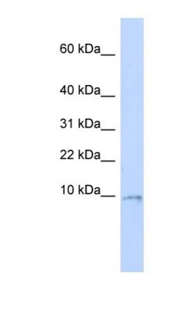 UQCR10 Antibody, Novus Biologicals 0.05mg; Unlabeled:Antibodies, Polyclonal