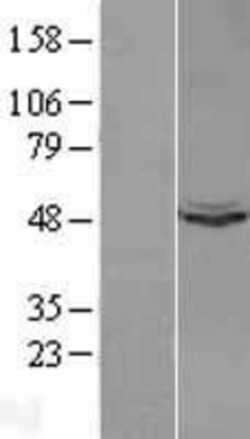 Novus Biologicals™ UQCRC1 Overexpression Lysate