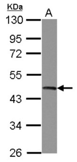 UQCRC2 Antibody, Novus Biologicals 0.1mL; Unlabeled:Antibodies, Polyclonal