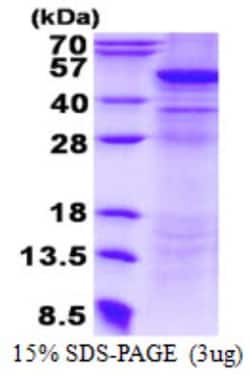 Novus Biologicals&trade;&nbsp;Recombinant Human UQCRC2 His Protein