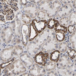 UQCRC2 Antibody, Novus Biologicals:Antibodies:Primary Antibodies