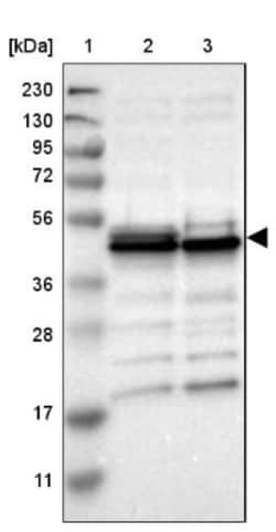 UQCRC2 Antibody, Novus Biologicals:Antibodies:Primary Antibodies