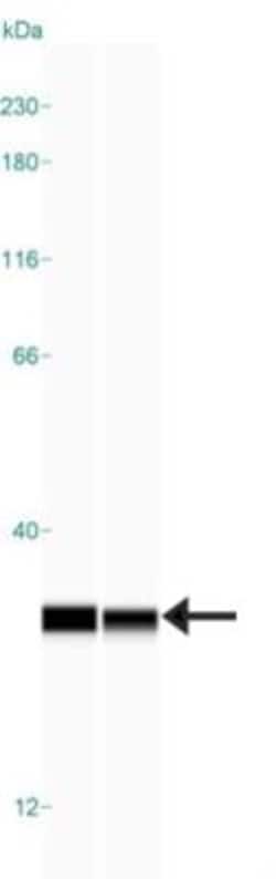 UQCRFS1 Antibody, Novus Biologicals 25 &mu;L | Buy Online | Novus Biologicals | Fisher Scientific