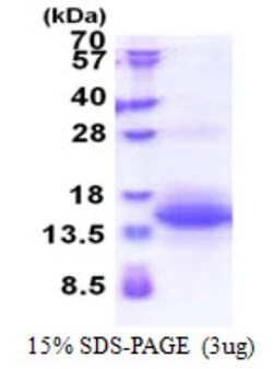 Novus Biologicals&trade;&nbsp;Recombinant Human UQCRH His Protein