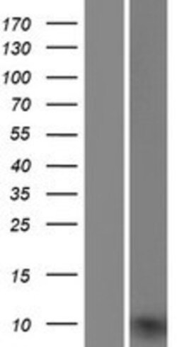 Novus Biologicals&trade;&nbsp;UQCRQ Overexpression Lysate