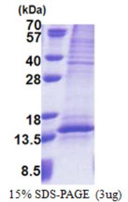 Novus Biologicals&trade;&nbsp;Recombinant Human UQCRQ His Protein