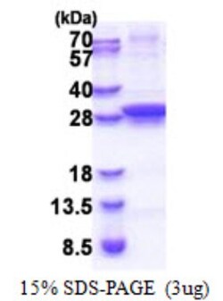 Novus Biologicals&trade;&nbsp;Recombinant E. coli UNG His Protein