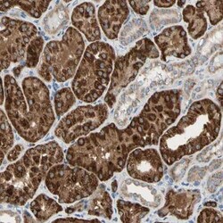 URB2 Antibody, Novus Biologicals:Antibodies:Primary Antibodies