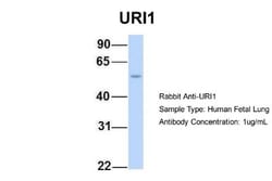 URI Antibody, Novus Biologicals:Antibodies:Primary Antibodies