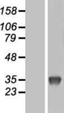 Novus Biologicals&trade;&nbsp;Uridine Phosphorylase 1/UPP1 Overexpression Lysate