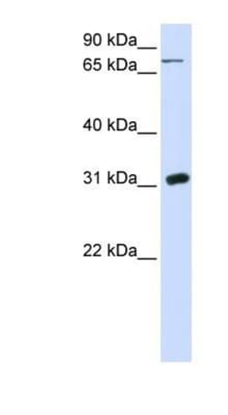 Uridine Phosphorylase 1/UPP1 Antibody, Novus Biologicals:Antibodies:Primary