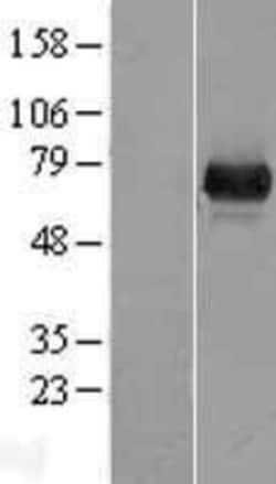 Novus Biologicals™ UROC1 Overexpression Lysate