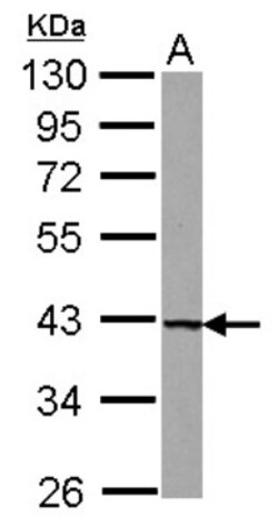 UROD Antibody, Novus Biologicals 0.1 mL | Buy Online | Novus Biologicals | Fisher Scientific