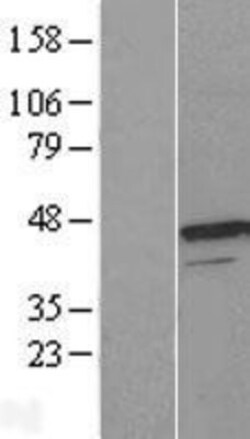 Novus Biologicals™ UROD Overexpression Lysate