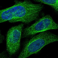 UROD Antibody, Novus Biologicals 0.1mL; Unlabeled:Antikörper