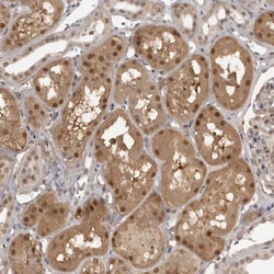UROD Antibody, Novus Biologicals 0.1mL; Unlabeled:Antikörper