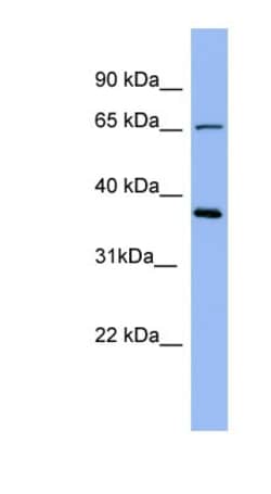 Uromodulin Antibody, Novus Biologicals 100&mu;L; Unlabeled:Antibodies,