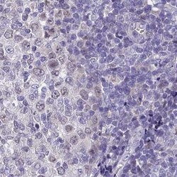 Uroplakin II Antibody, Novus Biologicals:Antibodies:Primary Antibodies