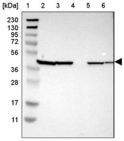 Uroplakin IIIB Antibody, Novus Biologicals:Antibodies:Primary Antibodies
