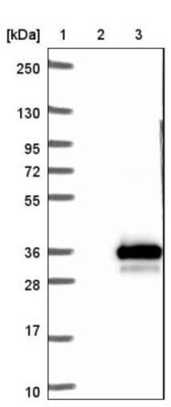 UROS Antibody, Novus Biologicals:Antibodies:Primary Antibodies