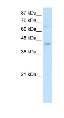 Use1/UBE2Z Antibody, Novus Biologicals 100&mu;L; Unlabeled:Antibodies,