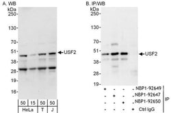 USF2 Antibody, Novus Biologicals 0.1mg; Unlabeled:Antibodies, Polyclonal