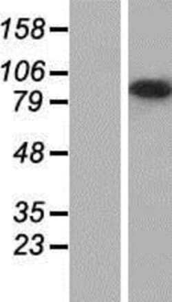 Novus Biologicals&trade;&nbsp;USH1C Overexpression Lysate